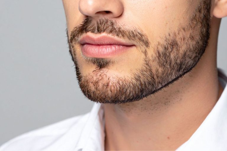 masculinización